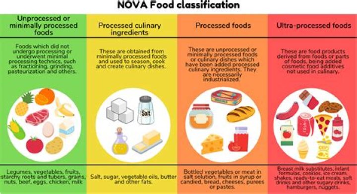 What are examples of product-level activities?