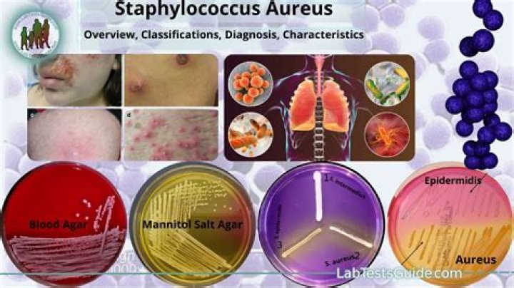 What does Staphylococcus aureus need to grow?