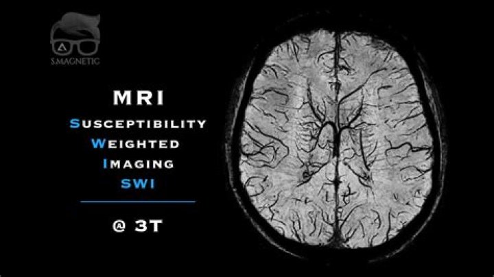 What is T1w in MRI?