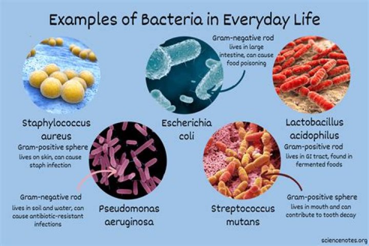 What type of bacteria grows in milk?