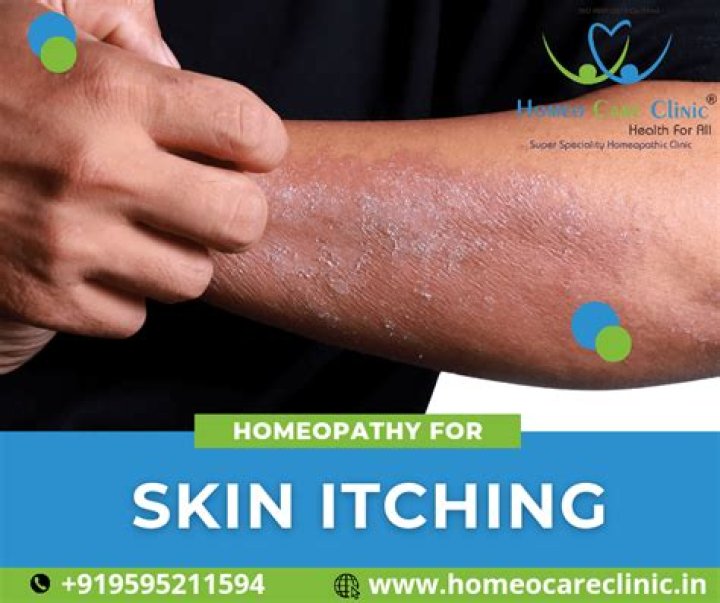 Which ointment is best for itching on skin?
